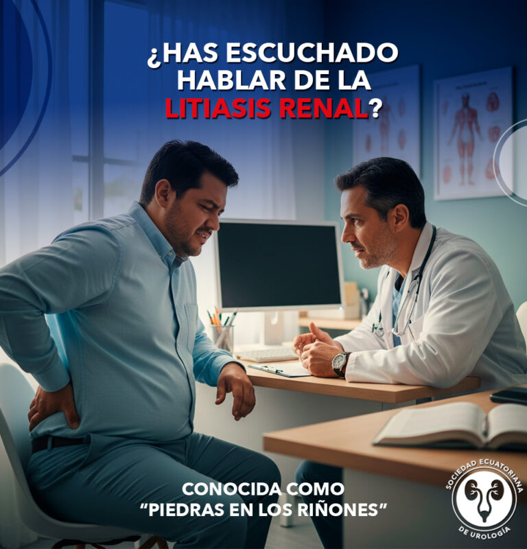 Litiasis renal: causas, síntomas y prevención de piedras en los riñones