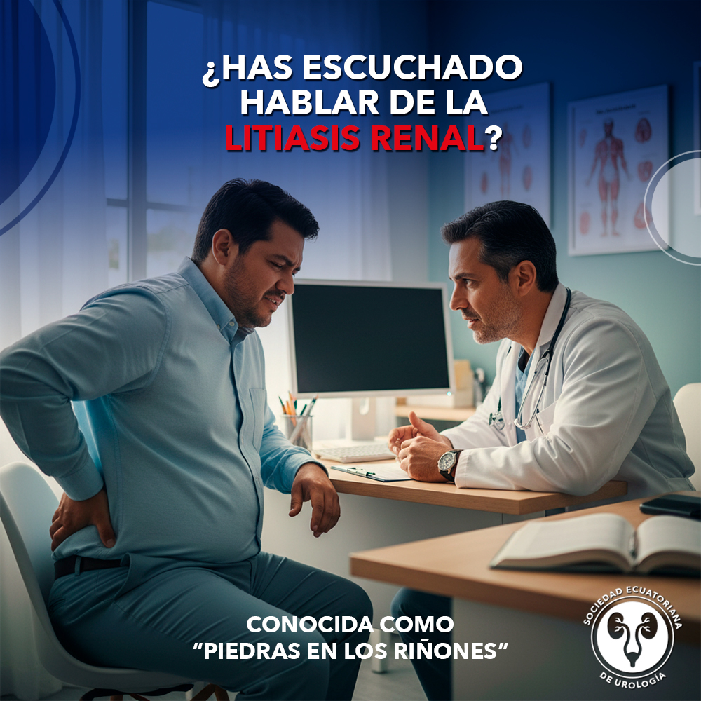 Litiasis renal: causas, síntomas y prevención de piedras en los riñones