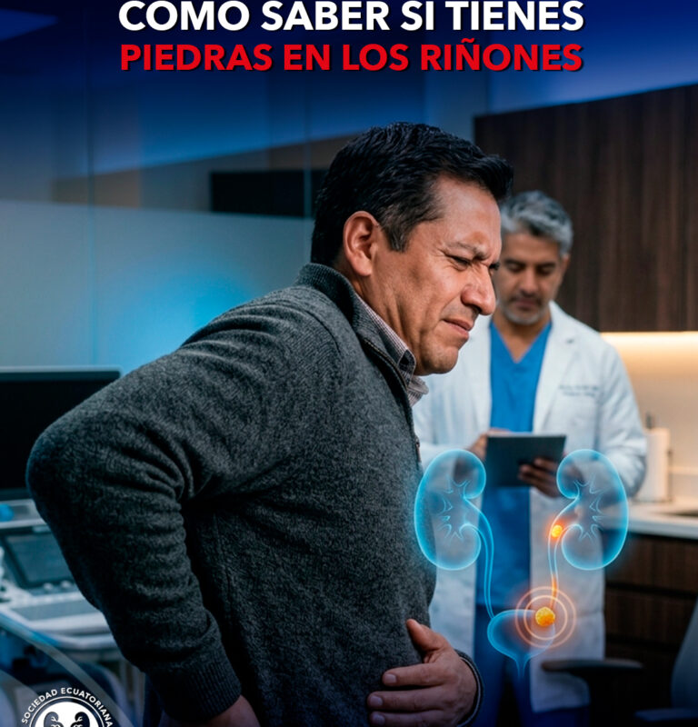 Cómo saber si tienes piedras en los riñones 26 Cómo saber si tienes piedras en los riñones
