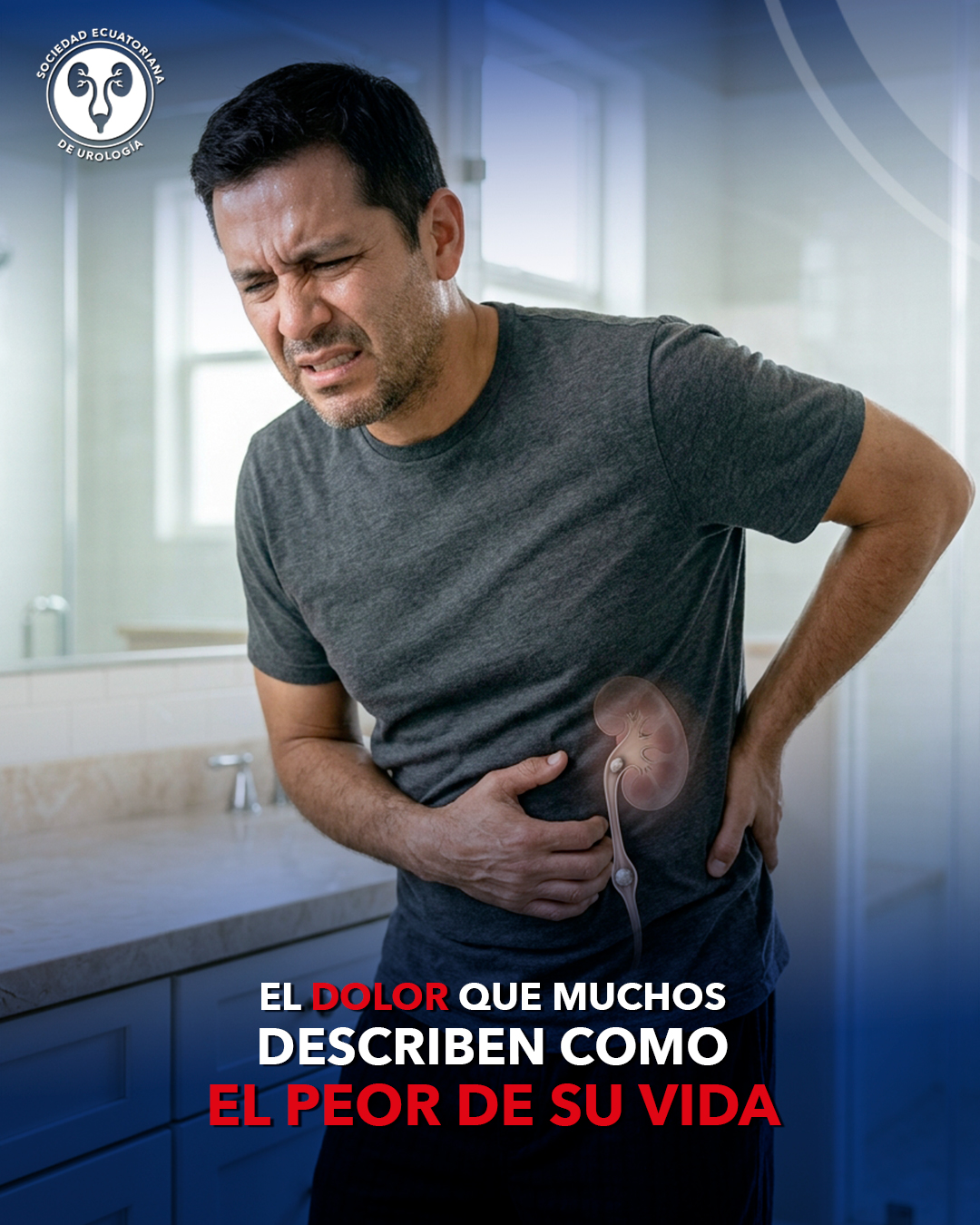 El dolor que muchos describen como el peor de su vida 10 cólico renal